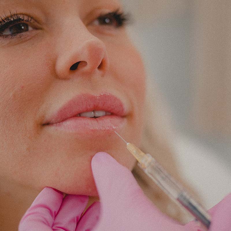 a perfect pout dermal filler injection at honey skincare studio arlington va