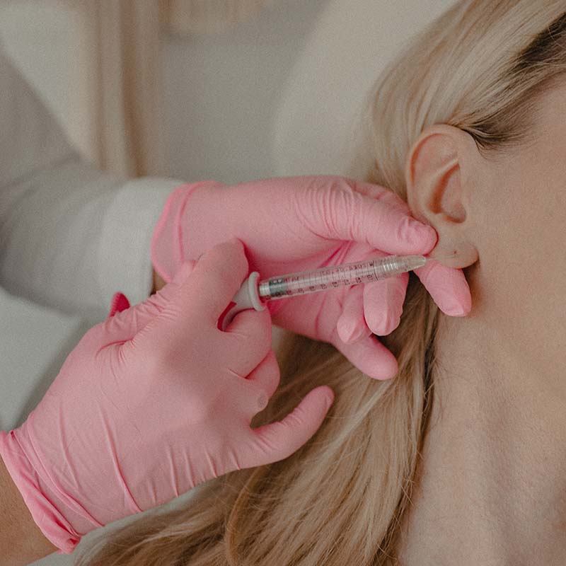 earlobe filler at honey skincare clinic, arlington va