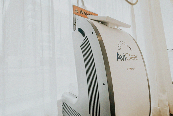 aviclear laser treatment at honey skincare studio