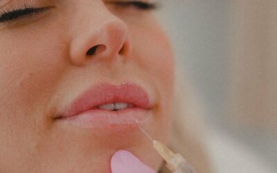 Botox Lip Flip vs Filler: Comparing Techniques for Perfecting Your Pout