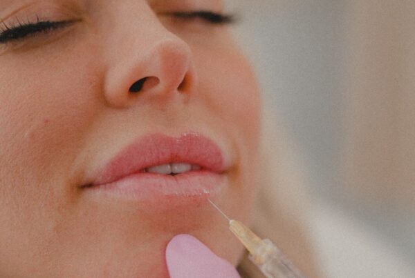botox lip flip vs. filler honey skincare studio