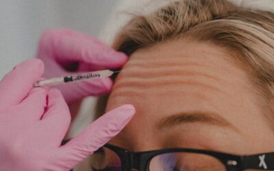 Cracking the Botox Code: How Often You Should Get Treatments and an Age-specific Guide for Botox Use