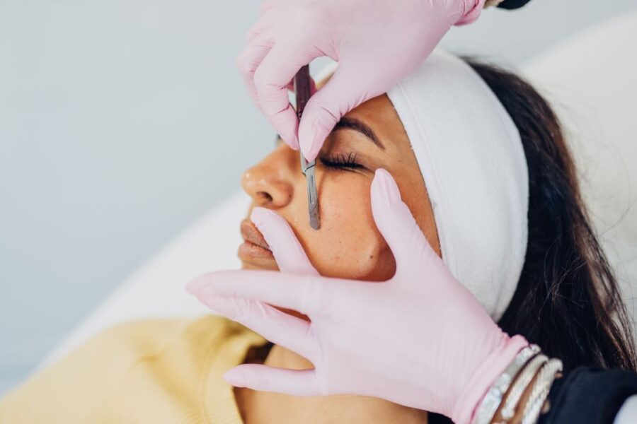 how many chemical peels do you need