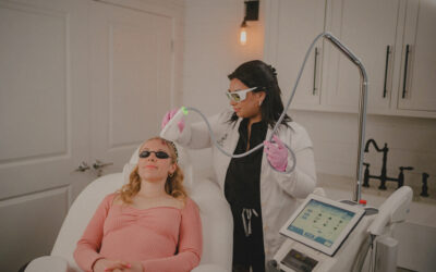 MOXI Laser Treatment for Melasma: Everything you need to know