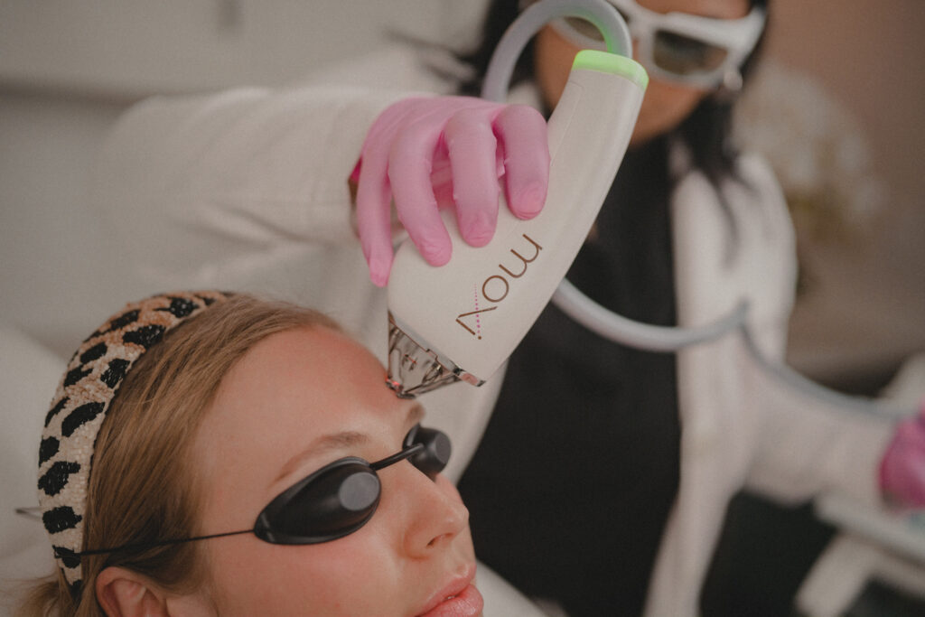 moxi laser treatment