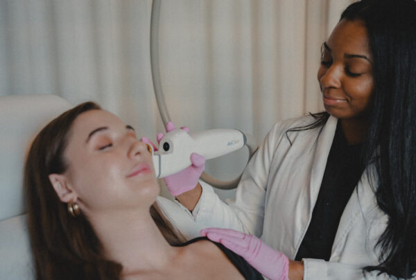 AviClear Acne Laser Treatment