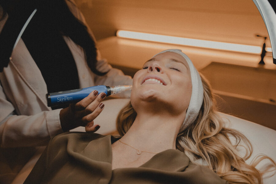 Microneedling vs Clear + Brilliant Laser
