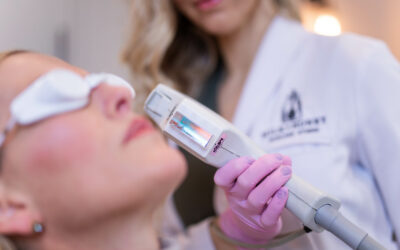 When and Why Should You Consider Facial Vein Treatments?