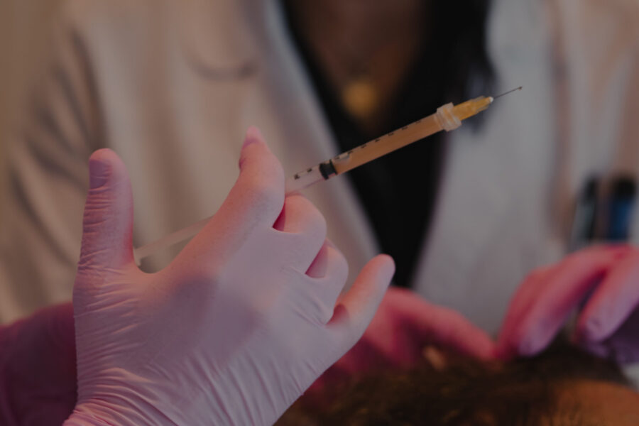 PRP for hair restoration