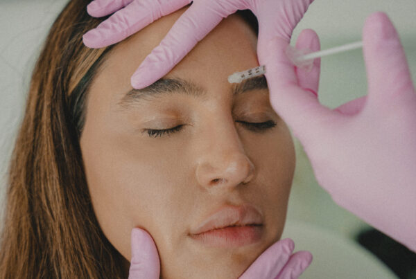 Exercising After Botox