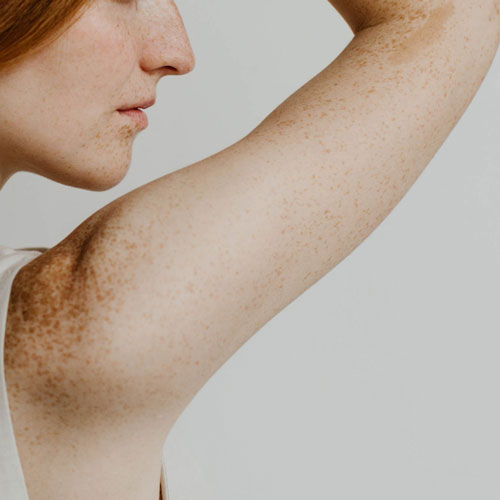 woman at a medical spa in Arlington, VA